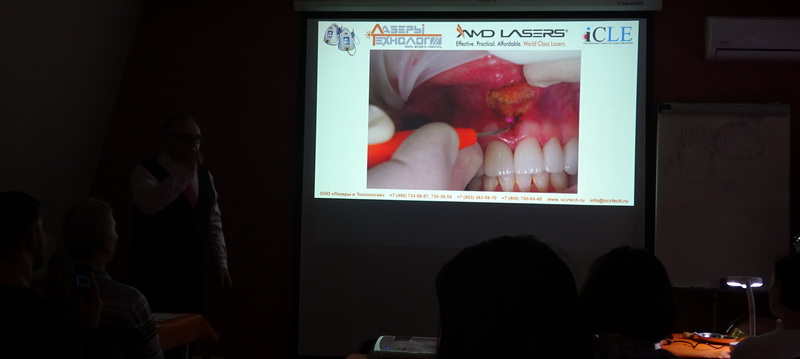 Отзывы начинающих пользователей стоматологических лазеров и опытных лазерологов